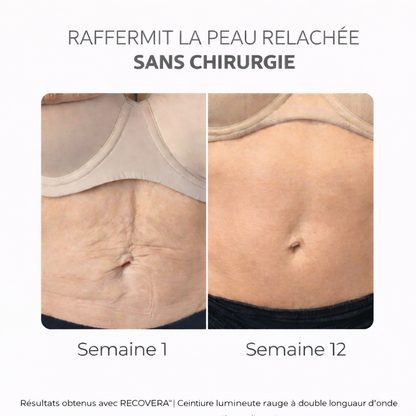 RECOVERA™ | Ceinture lumineuse rouge à double longueur d'onde